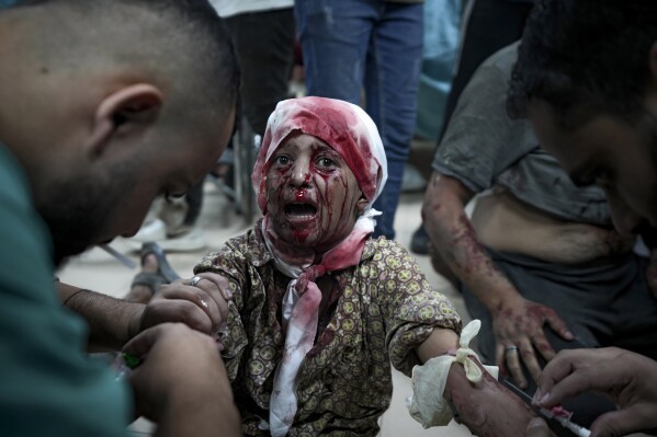 A Palestinian child wounded in the Israeli bombardment of the Gaza Strip is treated at a hospital in Deir al-Balah, Thursday, Oct. 10, 2024. (AP Photo/Abdel Kareem Hana)